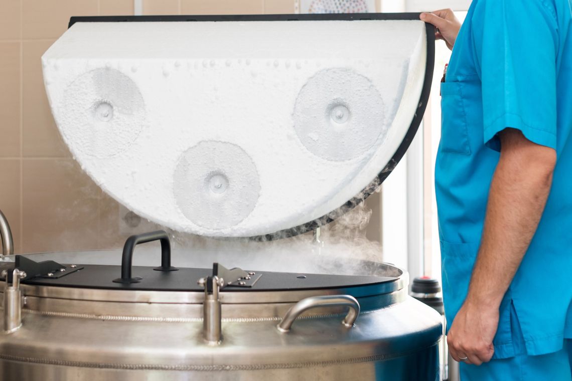 Jakie naczynie Dewara na ciekły azot warto wybrać? Dowiedz się, gdzie kupić odpowiednie Jakie naczynie Dewara na ciekły azot warto wybrać? Dowiedz się, gdzie kupić odpowiednie